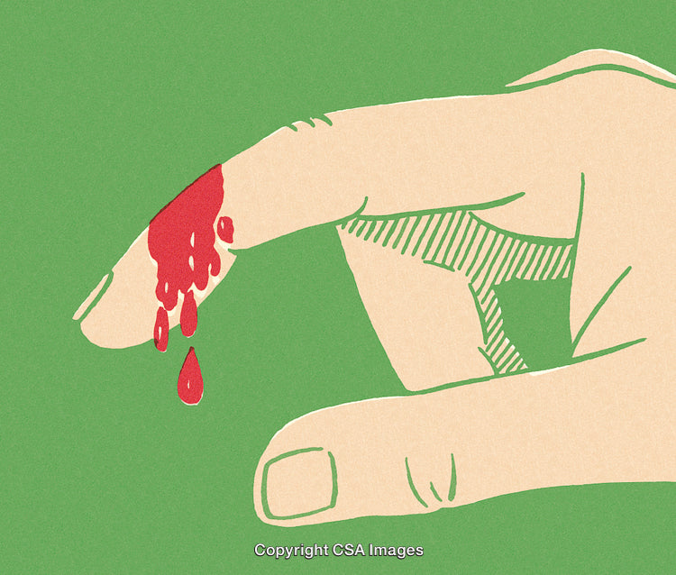 Illustration of a Hand with a Bleeding Cut on Green Background