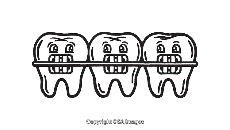 Black and White Line Art of Teeth with Braces in a Row