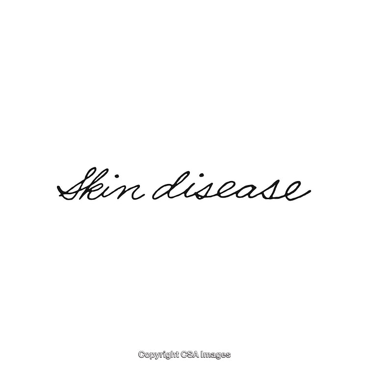 Elegant Handwritten Text Depicting the Words 'Skin Disease' in Black