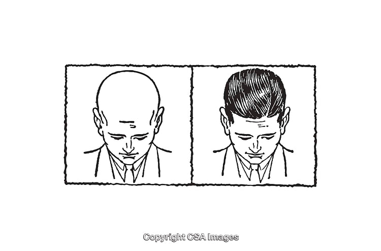 Black and White Line Art Depicting Before and After Views of Hair