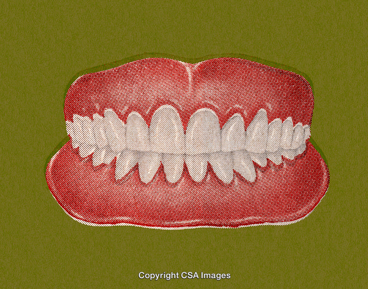 Artistic Illustration of Teeth in a Retro Halftone Style on Green Background