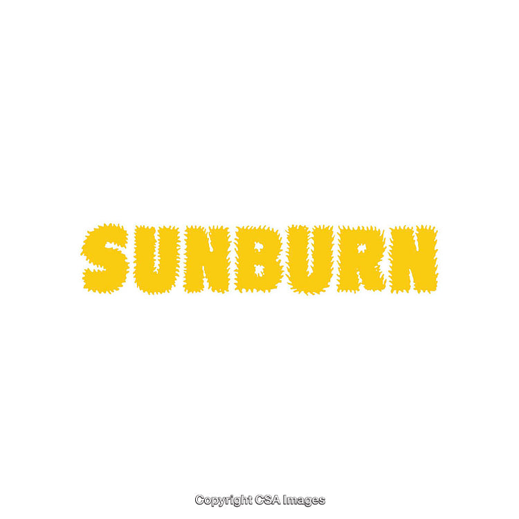 Sunburn Text with Yellow Spiky Design on a White Background