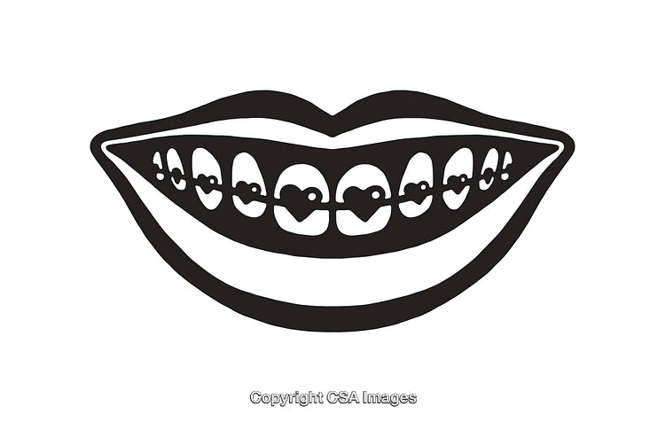 Black and White Line Art of a Smiling Mouth with Braces