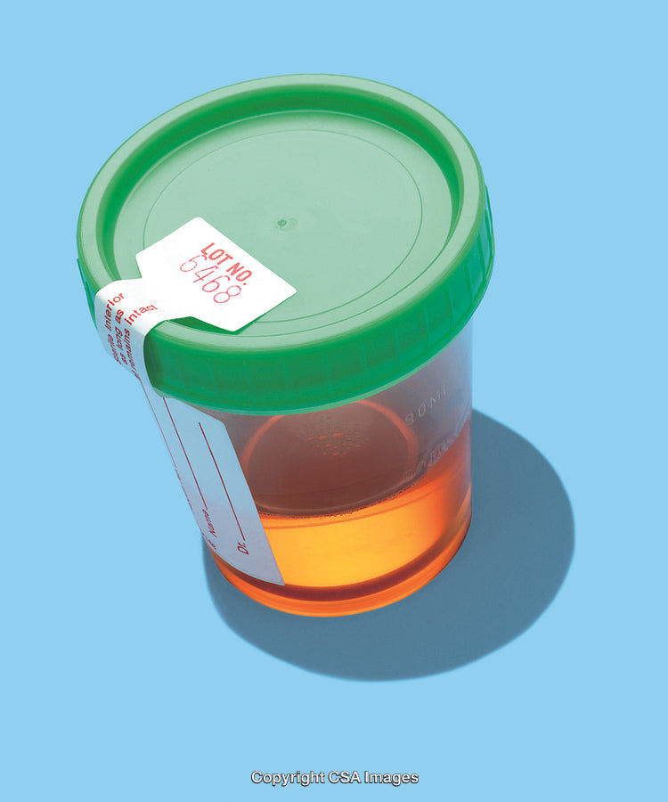 Close-Up of Plastic Urinalysis Container With Green Lid on Blue Surface