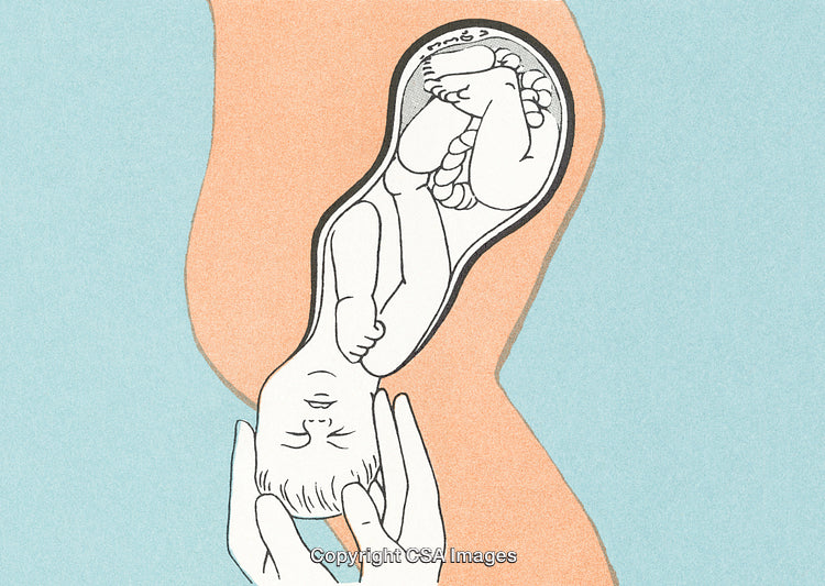 Illustration of Childbirth Showing Baby Delivery in Cutaway View