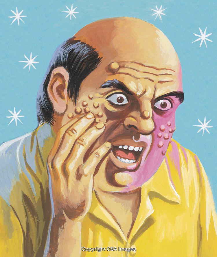 Illustration of a Surprised Man with Angry Expression and Facial Blemishes