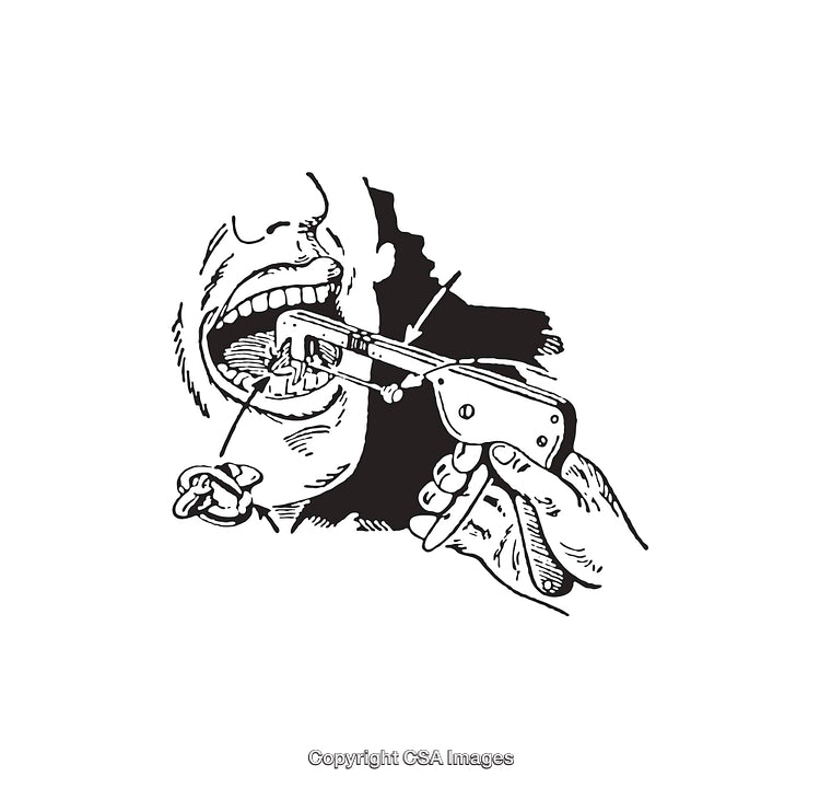 Black and White Line Art of Dental Examination Procedure