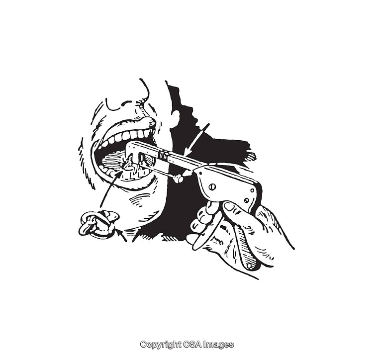 Black and White Line Art of Dental Examination Procedure