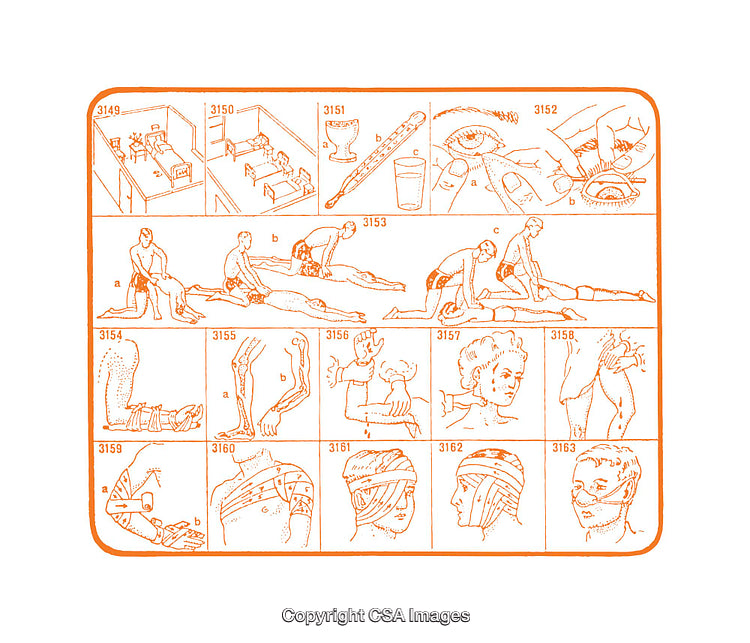 Medical Diagrams Demonstrating First Aid Procedures and Basic Emergency Steps