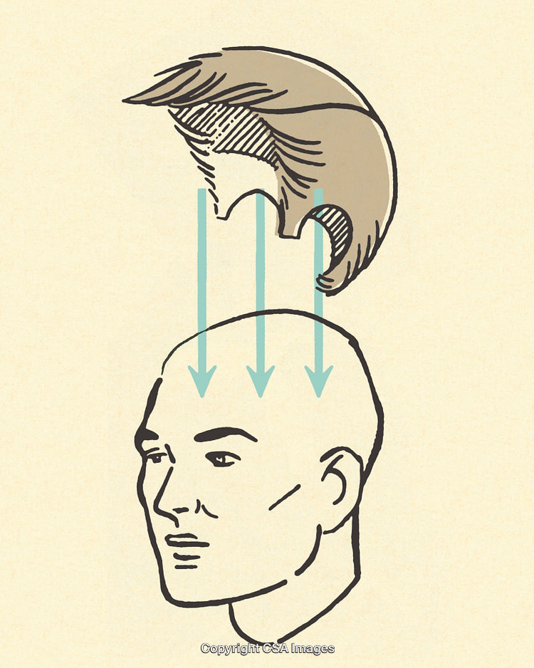 Illustration of a Hairpiece Being Placed on a Bald Human Head