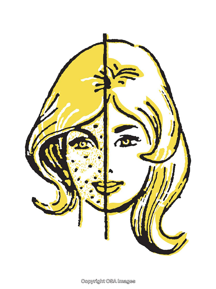 Illustration Comparing Clear Versus Blemished Skin in Split Facial View