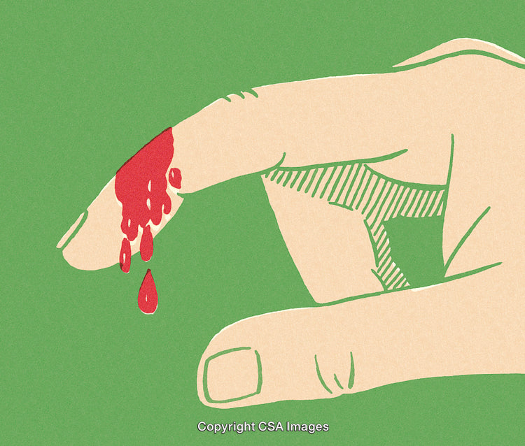 Illustration of a Hand with a Bleeding Cut on Green Background
