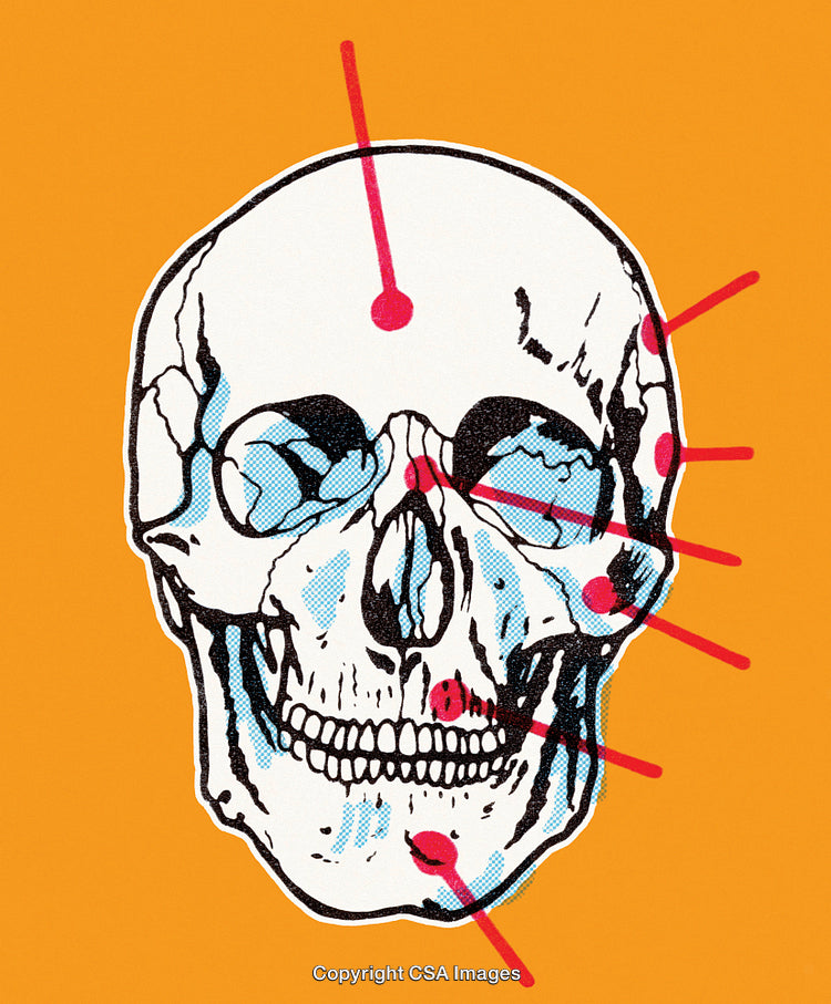 Colorful Anatomical Skull Illustration Highlighting Key Points on Orange Background