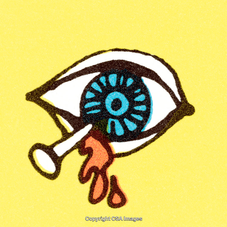 Surreal Illustration of an Eye with Nail and Dripping Blood on Yellow Background