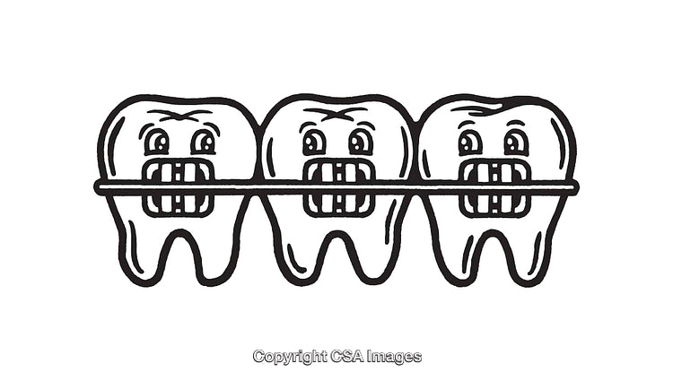 Black and White Line Art of Teeth with Braces in a Row