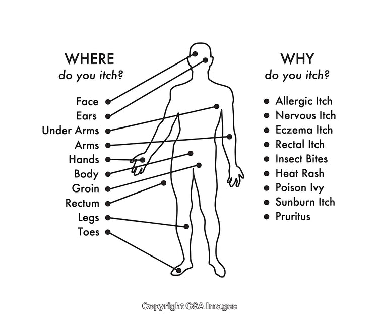 Black and White Diagram of Itch Locations and Potential Causes
