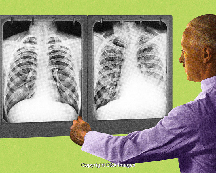Doctor Reviewing Chest X-Rays Against a Bright Green Background