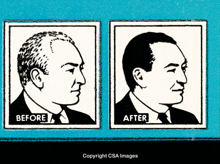 Illustration of Before and After Transformation With Hair Changes Profile View
