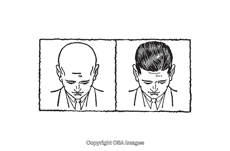 Black and White Line Art Depicting Before and After Views of Hair