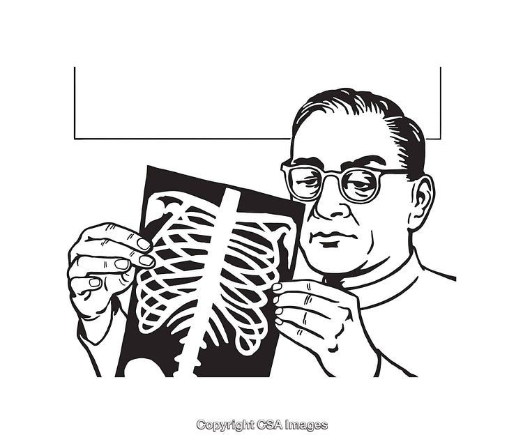 Black and White Illustration of a Doctor Examining a Chest X-Ray