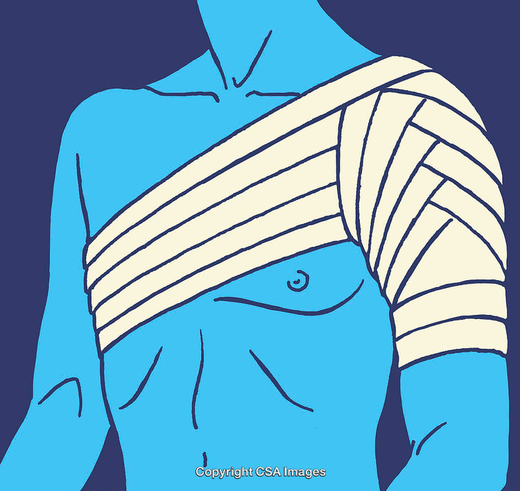 Illustration of a Blue-Toned Human Torso with Bandaged Shoulder