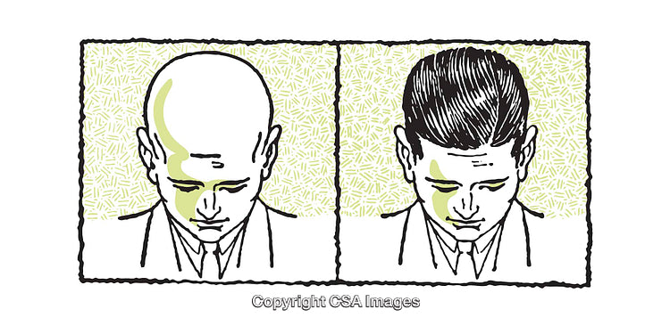 Illustration Depicting Before and After Hair Transformation Concept