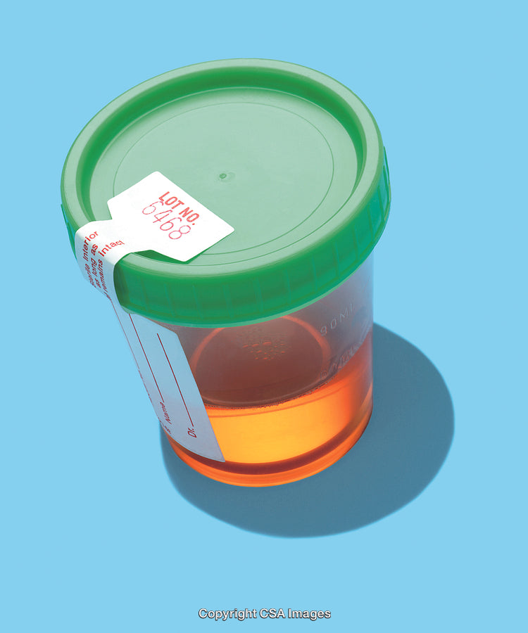 Close-Up of Plastic Urinalysis Container With Green Lid on Blue Surface