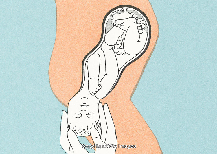 Illustration of Childbirth Showing Baby Delivery in Cutaway View