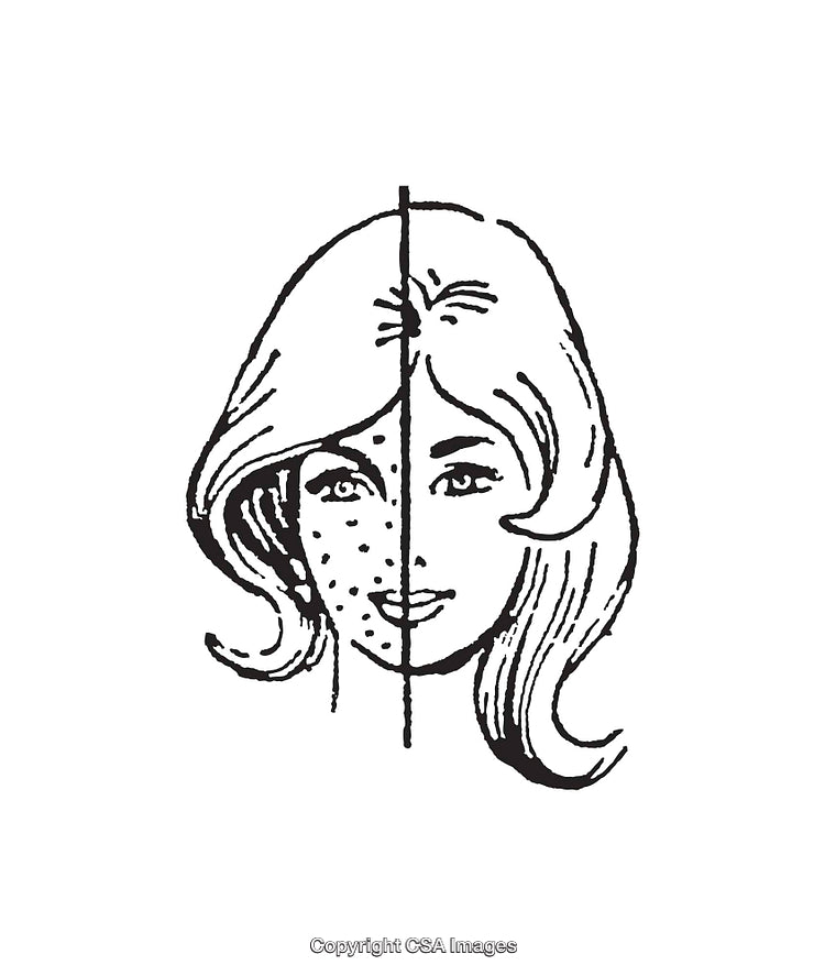 Black and White Line Art Illustration of Face Skincare Transformation