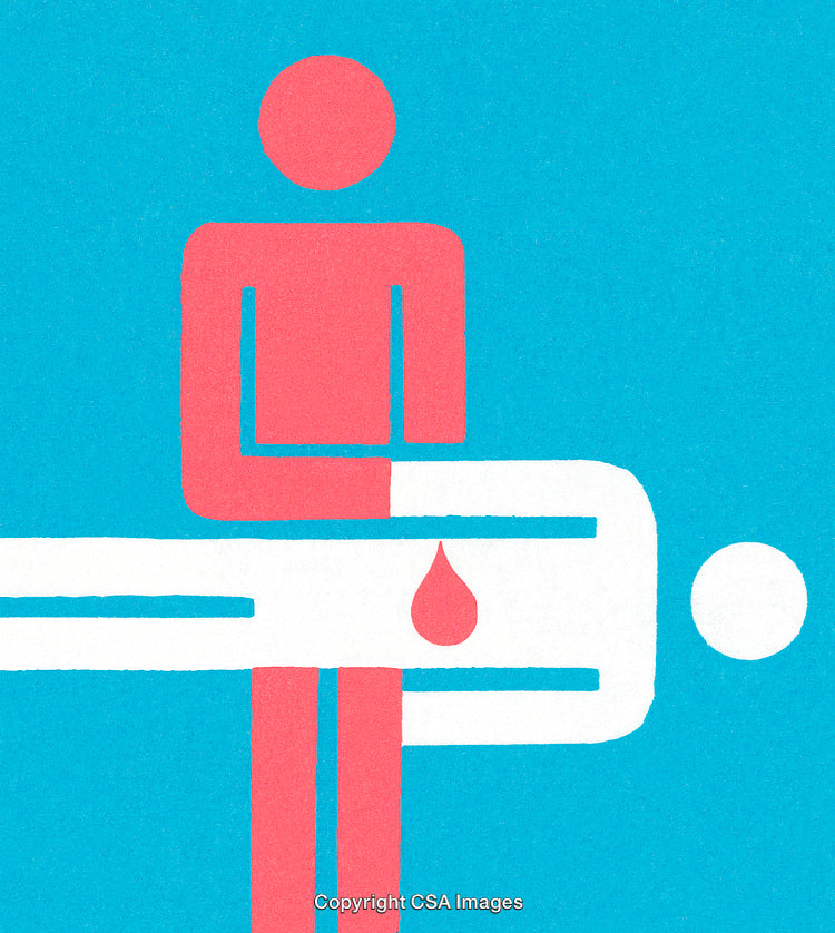 Abstract Illustration Depicting Medical Procedure in Minimalist Style