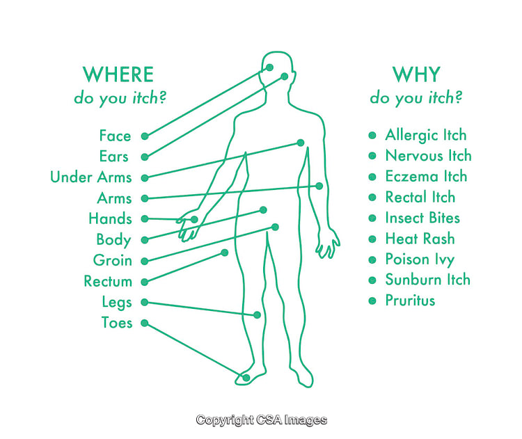 Diagram Showing Causes and Locations of Itching in the Human Body